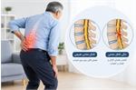 تنگی کانال در MRI همیشه به معنای ضرورت جراحی نیست!